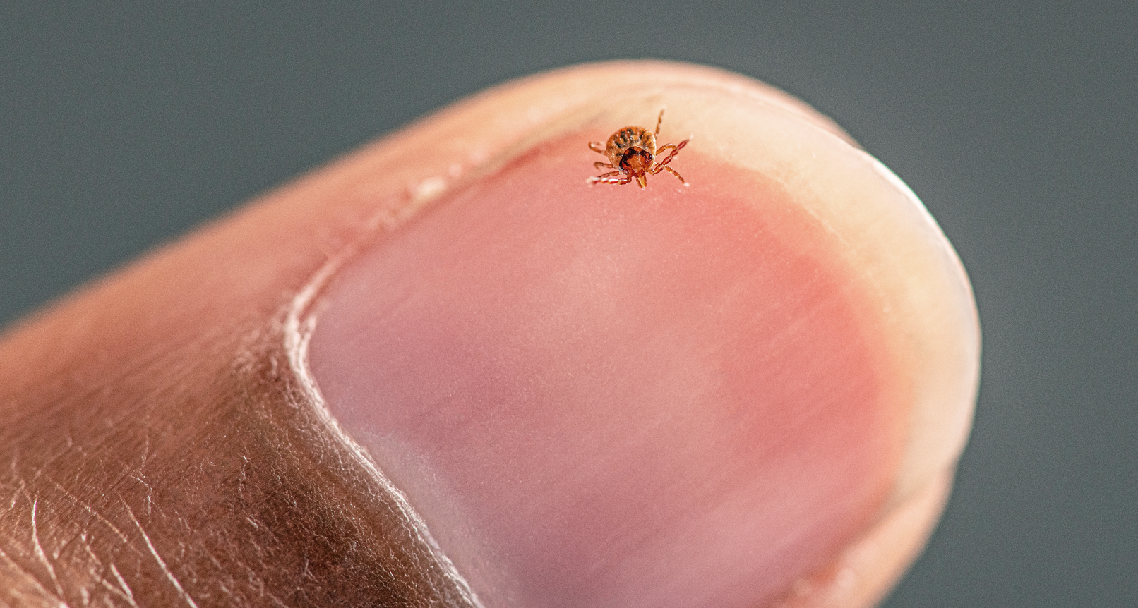 a lone star tick, Amblyomma americanum, nymph, crawling on a person’s fingernail. a lone star tick, Amblyomma americanum, nymph, crawling on a person’s fingernail.